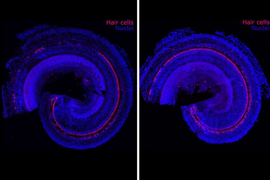 Sur ce modèle pré-clinique, les cellules régénérées apparaissent en rose. À gauche, l'échantillon contrôle, à droite, celui traité par FX-322. © Hinton AS, Yang-Hood A, Schrader AD, Loose C, Ohlemiller KK, McLean WJ
