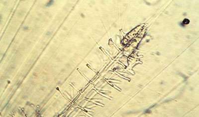 Reconstruction d'une épine cassée de radiolaire (Octodendron). Un manchon granuleux se forme et précède une épine en silice reconstruite en une heure. Les traits irisés correspondent à des axopodes (caractéristiques des radiolaires). © N. Swanberg 
