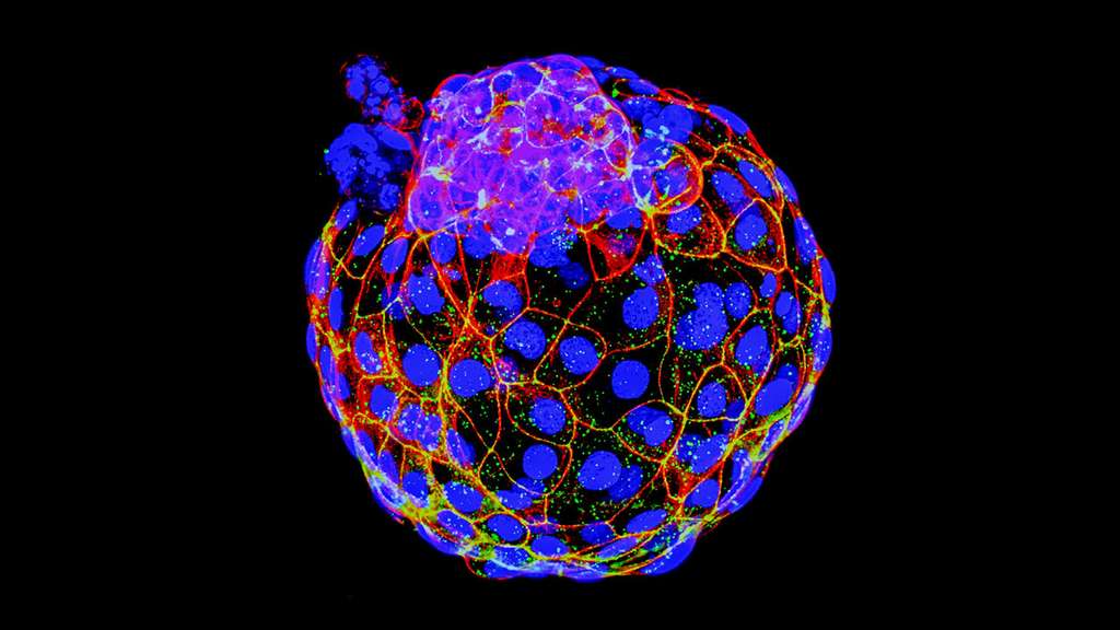 Une équipe américaine et une autre australienne sont parvenues à récréer des embryons humains au stade blastocyste, soit au 5e jour de leur développement. © University of Texas Southwestern Medical Center