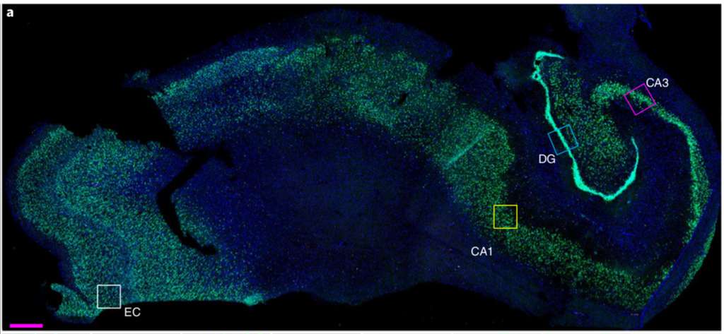 Les neurones immatures se forment dans le gyrus denté (noté ici DG), une région de l’hippocampe, la partie du cerveau impliquée dans l’apprentissage, la mémoire et les émotions. © Elena P. Moreno-Jiménez et al, Nature Medicine, 2019