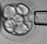 Des chercheurs ont pu obtenir des cellules souches embryonnaires humaines sans causer la mort de l'embryon utilisé Une première ! (Crédits : Advanced Cell Technology) Des chercheurs ont pu obtenir des cellules souches embryonnaires humaines sans causer la mort de l'embryon utilisé Une première ! (Crédits : Advanced Cell Technology)