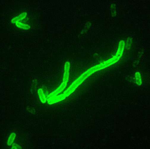 L’agent de la peste, Yersinia pestis, observé en microscopie à fluorescence. © hukuzatuna, Flickr, cc by nc nd 2.0 