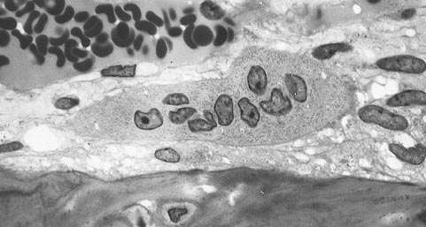 Les ostéoclastes, des cellules osseuses à plusieurs noyaux Les ostéoclastes, des cellules osseuses à plusieurs noyaux
