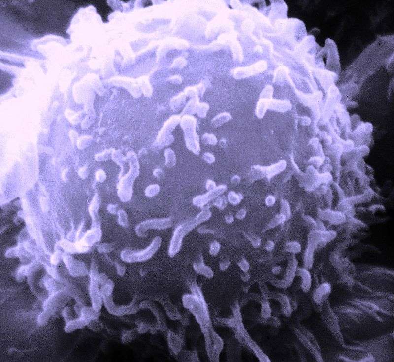 Les lymphocytes cytotoxiques activés dans la maladie auto-immune semblent les mêmes que ceux impliqués dans la réaction au virus HPV-16. © National Cancer Institute, DP