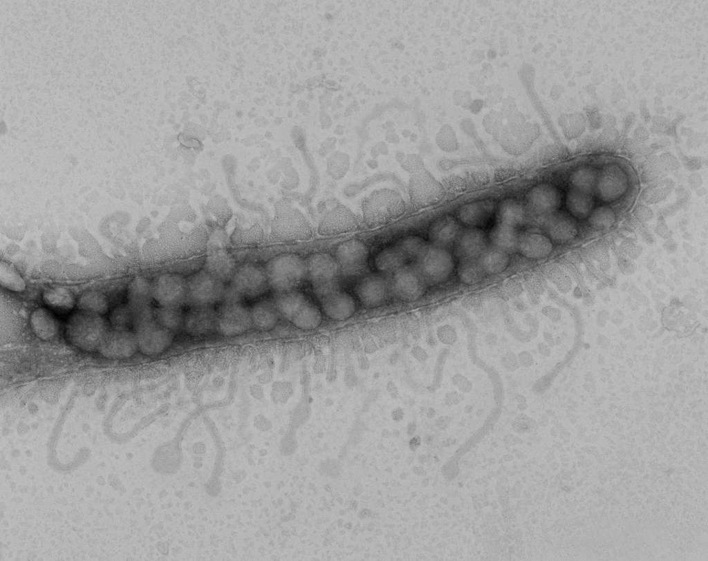 Cette bactérie océanique SAR11 a été infectée par des virus pélagiphages (ils correspondent aux boules situées à l'intérieur du micro-organisme). © Oregon State University