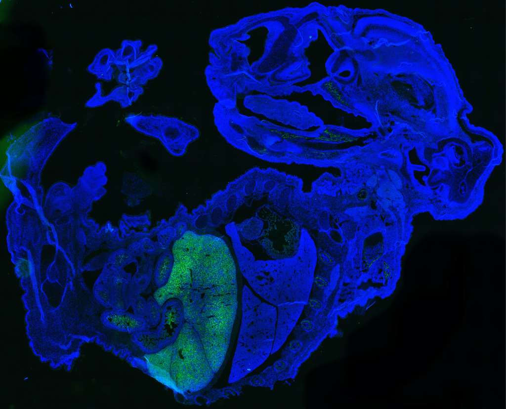 Cette image montre une grande quantité de cellules humaines (en vert) dans un embryon de souris de 17 jours (en bleu). La plupart des cellules humaines sont des globules rouges, qui s'accumulent dans le foie fœtal de la souris. © Zhixing Hu, Université de Buffalo