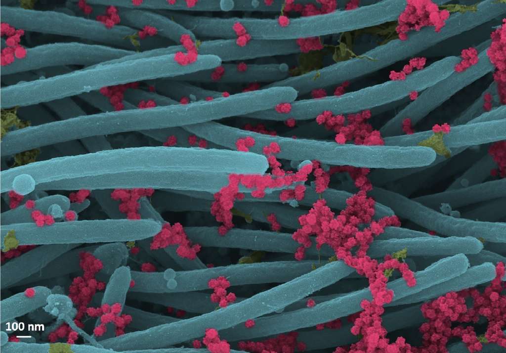 Les virions du SARS-CoV-2 (en rouge) tapissent les cellules ciliées bronchiques (en bleu). © Ehre Lab, UNC School of Medicine