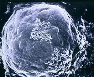 Cellule produtrice du virus HIV responsable du sida - copyright J.C. Chermann