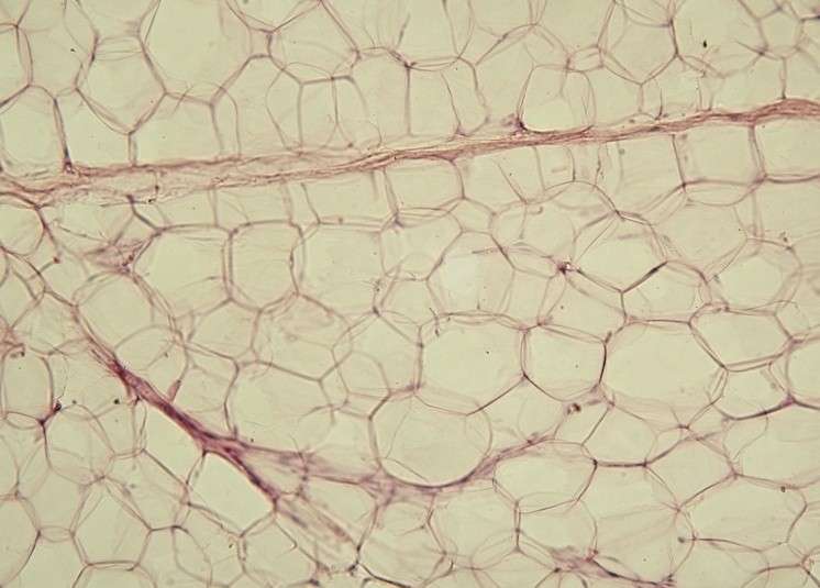 Le tissu adipeux (à l’image) se compose de différents types de cellules. Les adipocytes blancs servent au stockage de la graisse. Les adipocytes bruns, retrouvés chez les nouveau-nés et les animaux qui hibernent, brûlent les lipides. Dernièrement, des adipocytes beiges ont été découverts. Ils ont la même fonction que les cellules brunes, mais se retrouvent chez les adultes et n'ont pas la même origine. © Jagiellonian University, Wikipédia, cc by sa 3.0