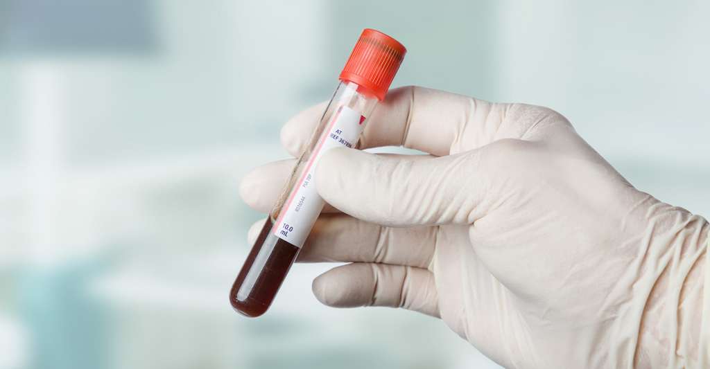 Le niveau de folates dans le sang peut être déterminé à partir d’un simple échantillon. Les chercheurs danois recommandent aujourd’hui un suivi généralisé. © StudioLaMagica, Fotolia