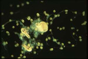 Nutrition de radiolaires : prédation. Une colonie de radiolaires se nourrit de jeunes amphipodes. © N. Swanberg