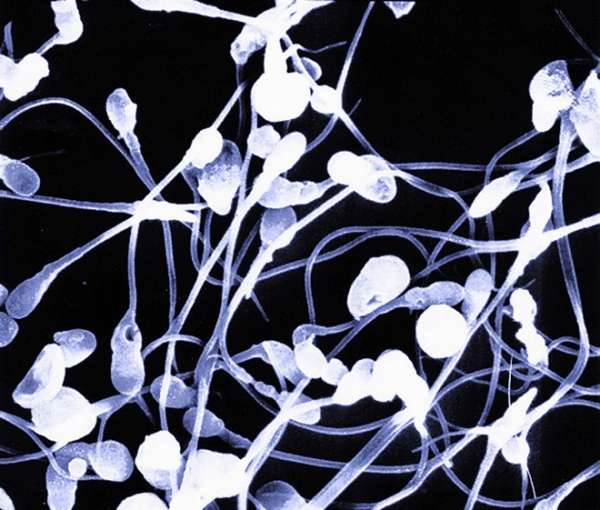 Les viandes industrielles diminuent le nombre de spermatozoïdes bien formés, et donc potentiellement capables de féconder l'ovule. © University of Utah, Andrology Microscopy Lab, Nasa