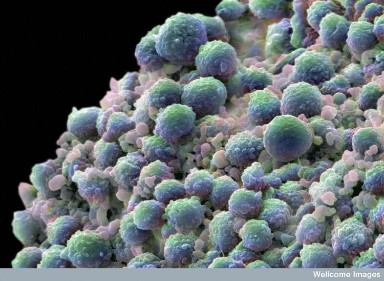 Des cellules de cancer de la prostate, comme celles-ci vues au microscope électronique à balayage, deviennent incapables de croître au contact du CAPE. Si l'on peut contrôler une tumeur, on pourra limiter la mortalité du cancer le plus fréquent chez l'homme. © Annie Cavanagh, Wellcome Images, images.wellcome.co.uk, cc by nc nd 2.0