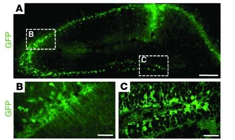 Visualisation des cellules humaines marquées par la GFP, dans l'hippocampe des souris quatre semaines après la greffe. © 2011, American Society for Clinical Investigation