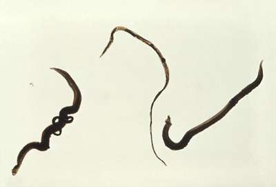 Ver parasite adulte Schistosoma mansoni. Crédit CDC-PHIL Work of US government.