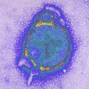 Le virus Hendra, potentiellement mortel pour l'Homme. © AJC1, Flickr CC by nc 2.0