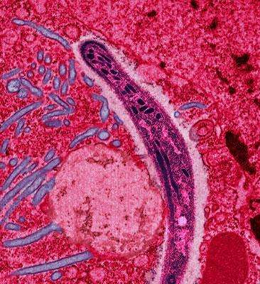 Le Plasmodium falciparum, ici visible au centre de cette image, est le vecteur du paludisme. Il colonise les cellules humaines et est transmis par la salive d'un moustique lors de la piqûre. © Ute Frevert, Wikipédia, cc by 2.5