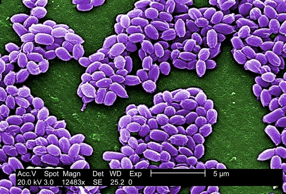 Des spores d’anthrax, une bactérie courante dans la nature mais dangereuse pour l'Homme. © Everett Historical, Shutterstock