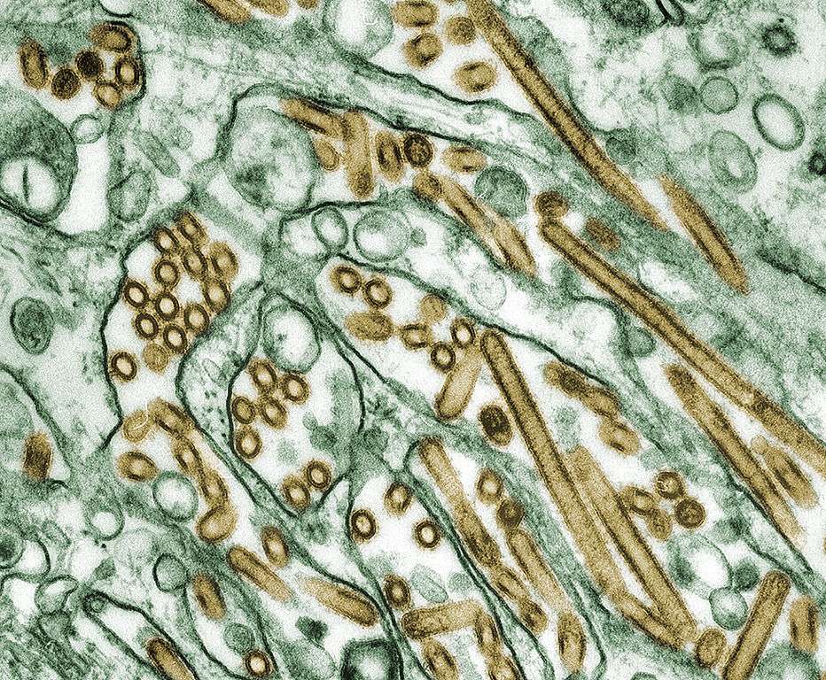 Le Virus A H5N1, à l'origine de la grippe qui fait trembler le monde Le Virus A H5N1, à l'origine de la grippe qui fait trembler le monde