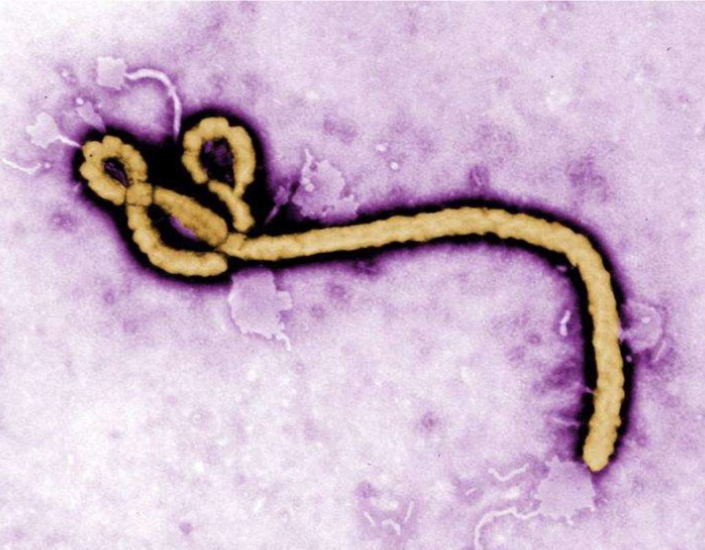 Électronographie du virus Ebola (microscopie électronique à transmission). © CDC Global, Flickr, CC by 2.0
