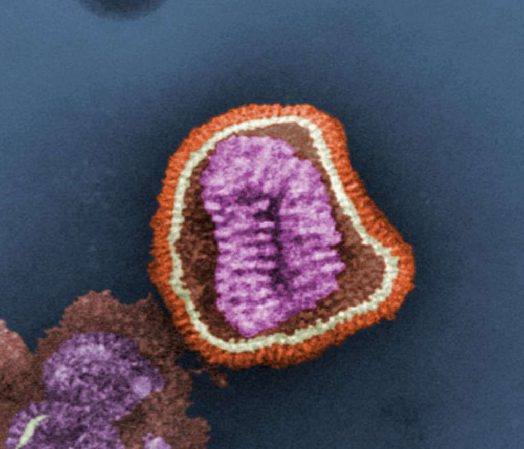 Le virus de la grippe comprend environ 13.000 bases, nettement plus que le bactériophage MS2, qui se compose de 3.569 nucléotides. Le premier est donc un peu moins difficile à détecter... © Cynthia Goldsmith, CDC, DP
