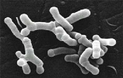 Les Hadzas n’ont pas de bactéries du genre Bifidobacterium dans leurs intestins, alors qu’on en retrouve chez des peuples d’agriculteurs à travers le monde. © Julie3601, Wikipédia, cc by sa 3.0