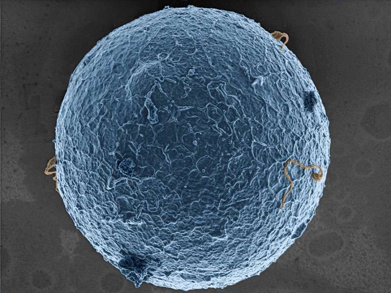 Spermatozoïdes et ovocyte