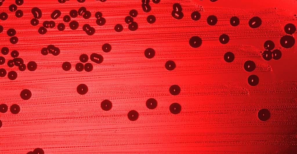 La méningite peut être bactérienne. Ici, la bactérie Hæmophilus influenzae. © CDC, W.A. Clark, DP