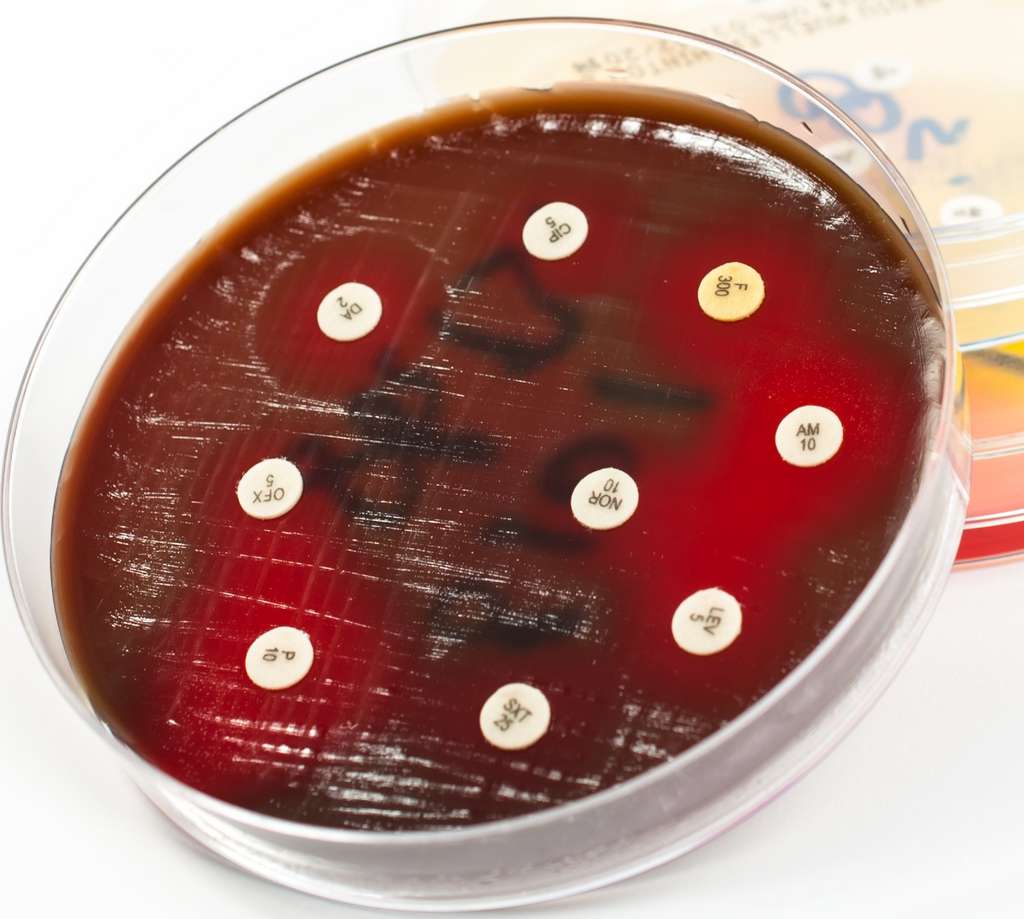 Un antibiogramme montrant la sensibilité d'une bactérie aux antibiotiques : contribution de la bactériologie dans le cas d'une infection ostéo-articulaire. © raresb, Adobe Stock 