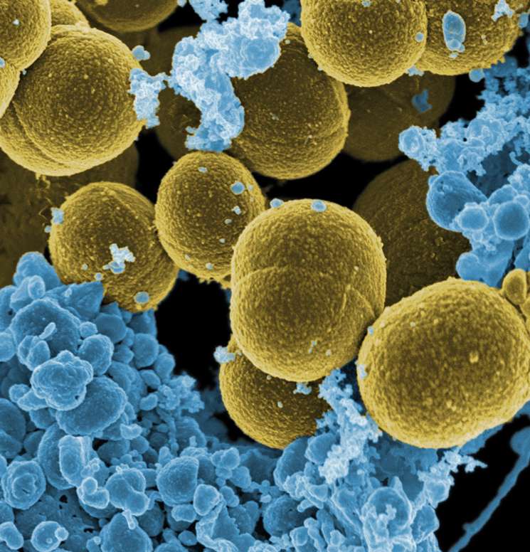 Le staphylocoque doré est de plus en plus résistant aux antibiotiques. Certaines souches, appelées Sarv, peuvent même résister à la vancomycine, un antibiotique utilisé comme dernier recours. © Microbe World, Flickr, cc by nc sa 2.0