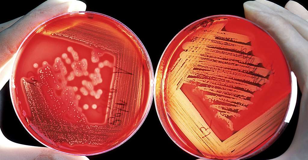Les toxines bactériennes sont de véritables poisons pour armes microbiologiques. Ici, des cultures de bactéries. © WikiImages CCO
