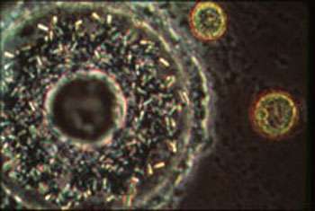 Capsule centrale pendant un stade de reproduction. On y voit des cristaux de SrSO4 (qui existent pendant cette phase particulière), des granules pigmentés bleus, une grosse gouttelette lipidique centrale, la membrane de la capsule centrale et des zooxanthelles symbiotiques à l'extérieur (vert-jaune). Diamètre des zooxanthelles : 10 µm. © N. Swanberg 