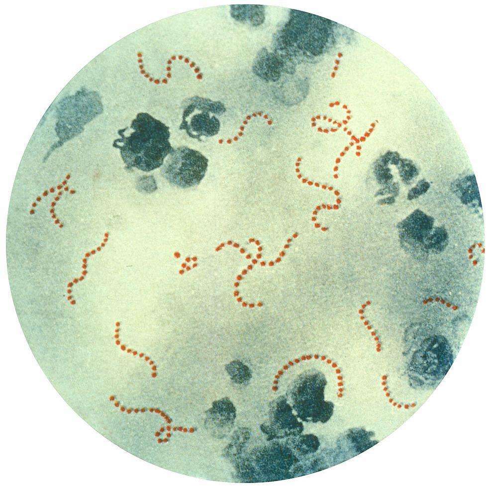 Les bactéries Streptococcus pyogenes sont de forme sphérique et elles s'agrègent entre elles pour former des chaînettes. Des estimations chiffrent à 700 millions le nombre d'infections qu'elles causent chaque année, parmi lesquelles environ 200.000 sont mortelles. © Centers for Disease Control and Prevention, Wikipédia, DP