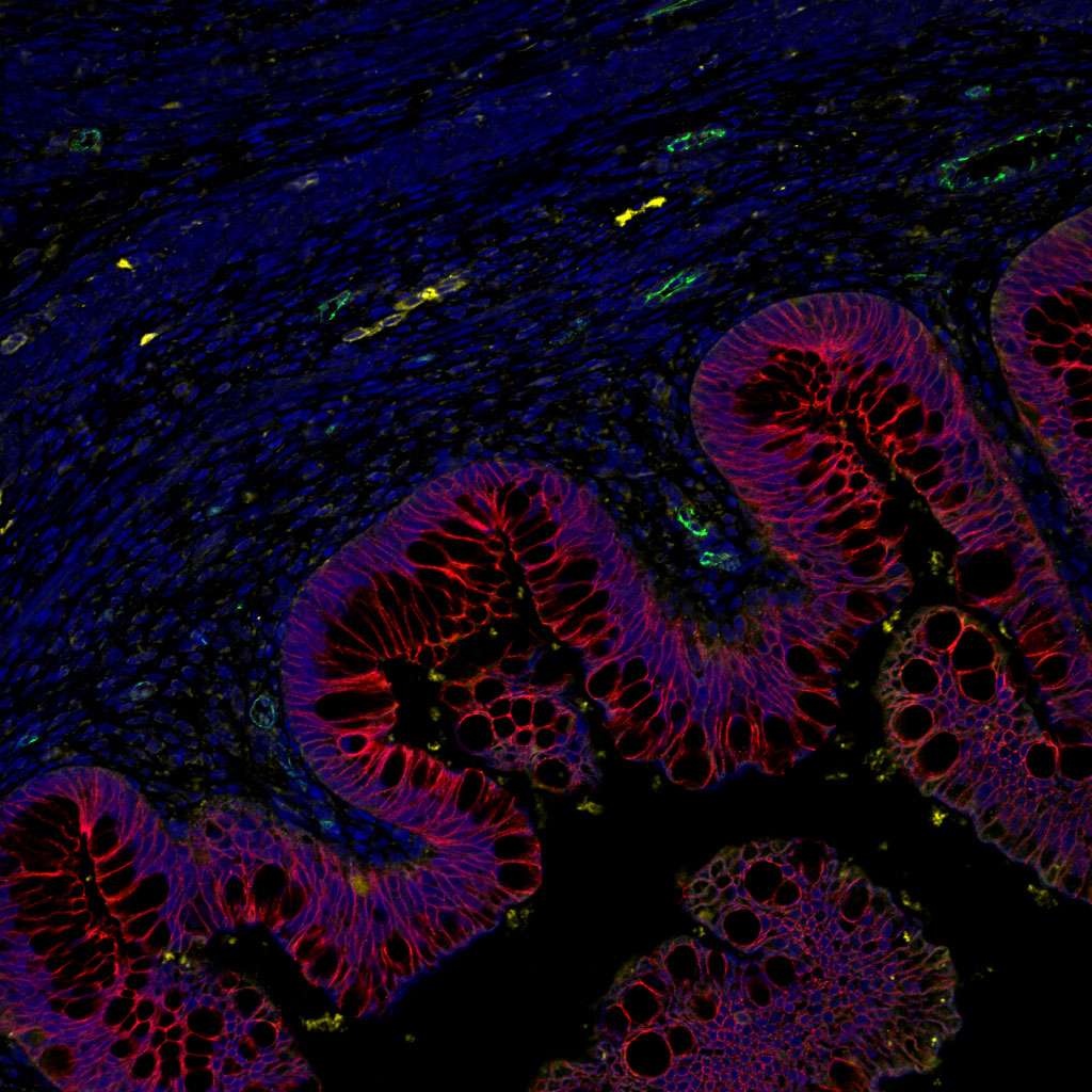 Cette image montre une coupe transversale d’un organoïde intestinal humain après transplantation chez la souris. L’épithélium intestinal apparaît en rouge. © Maxime M. Mahe, CCMH
