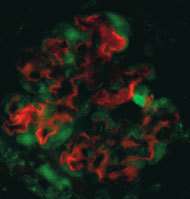 Après une greffe de moelle osseuse sur des souris atteintes par le syndrome d'Alport, les cellules des reins présentent les marqueurs des cellules introduites (Crédits : Raghu Kalluri) Après une greffe de moelle osseuse sur des souris atteintes par le syndrome d'Alport, les cellules des reins présentent les marqueurs des cellules introduites (Crédits : Raghu Kalluri)