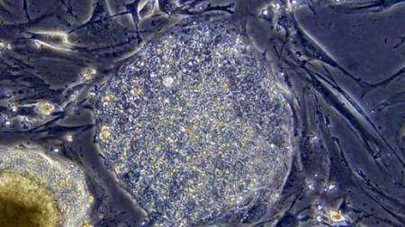 Cellule souche embryonnaire humaine non différenciée. Crédit : DR