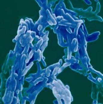 Un groupe de bacilles de Koch, responsables de la tuberculose. Le BCG est une variante, injectée vivante et qui ne protège - par immunité de surinfection - que si le germe continue à vivre dans l'organisme. Il s'installe généralement dans un ganglion. Crédit : Gounon, P. / Institut Pasteur Service Photo