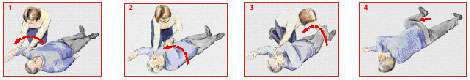 Les gestes de la PLS. © Croix-Rouge française, G. Pascaud Les gestes de la PLS. © Croix-Rouge française, G. Pascaud