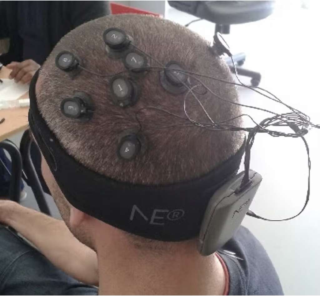 Aperçu d’un montage tDCS à plusieurs électrodes positionnées sur le cuir chevelu avec au centre l’électrode active (anode). © Stéphane Perrey, The Conversation