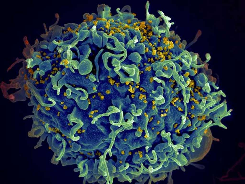 Un lymphocyte T humain (bleu) attaqué par le VIH (jaune), le virus responsable du SIDA. Le virus cible spécifiquement les lymphocytes T, qui jouent un rôle essentiel dans la réponse immunitaire de l’organisme contre les envahisseurs tels que les bactéries et les virus. Seth Pincus, Elizabeth Fischer et Austin Athman, National Institute of Allergy and Infectious Diseases / NIH