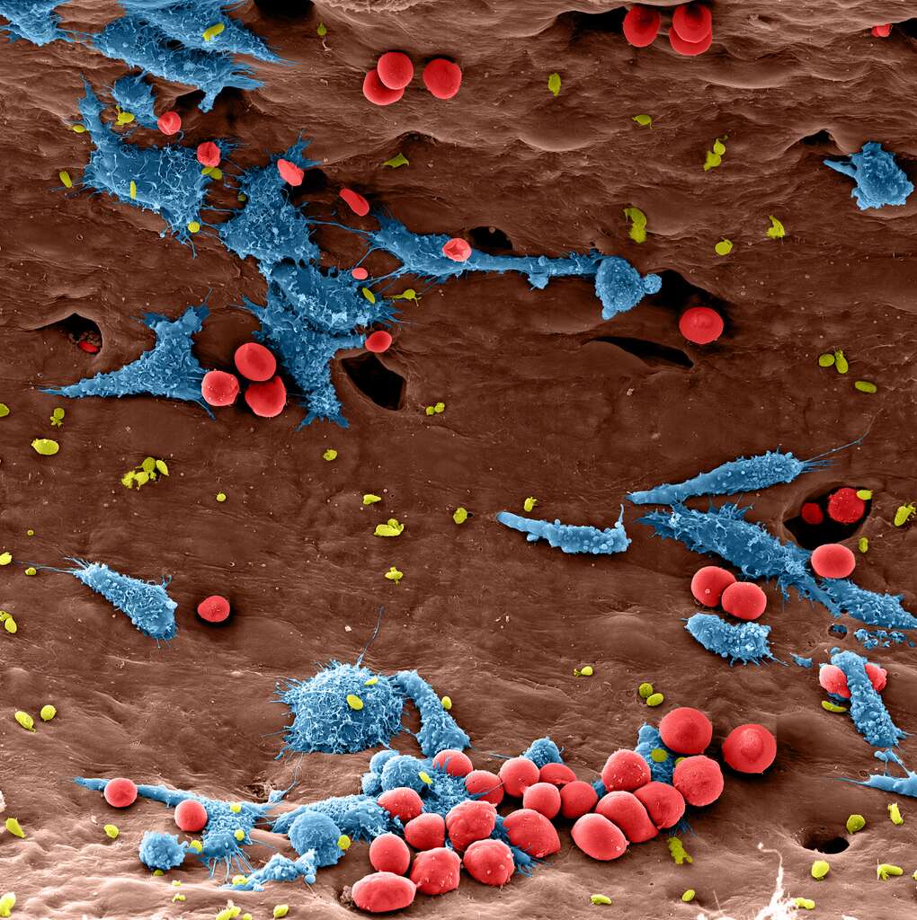 Des macrophages en pleine action Des macrophages en pleine action