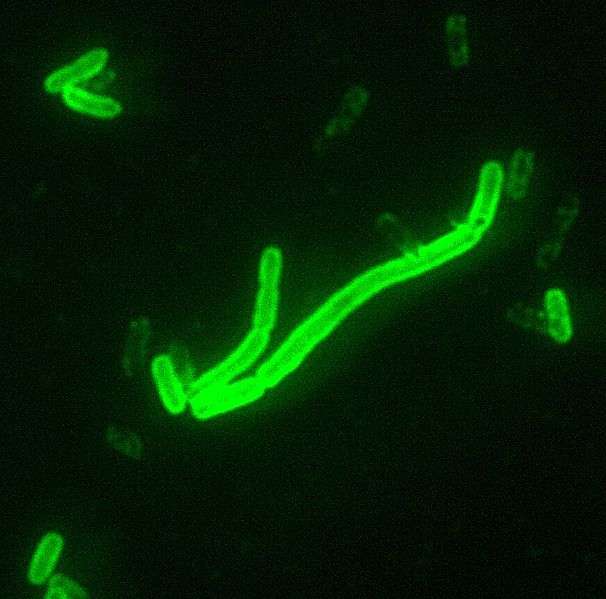 Yersinia pestis, ici en fluorescence, est la bactérie responsable de la peste. Elle évolue avec le temps et s'adapte peu à peu aux antibiotiques qu'on lui propose. Redeviendra-t-elle de nouveau l'un des nos pires ennemis à l'avenir ? © CDC, DP