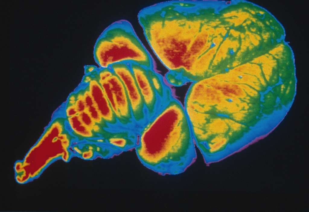 Image numérisée d'un cerveau de poussin, en fausses couleurs Image numérisée d'un cerveau de poussin, en fausses couleurs