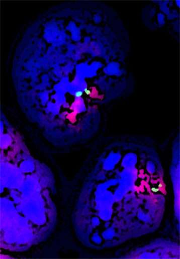 Les chromosomes X sont inactivés de façon aléatoire au cours du développement embryonnaire (en bleu l'ADN, en vert les chromosomes X et en rouge les ARN Xist). © Edith Heard, Institut Curie, Image du communiqué du CNRS