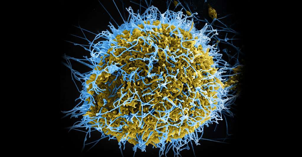 Virus Ebola. © NIAID, Flickr CC by-nc 2.0