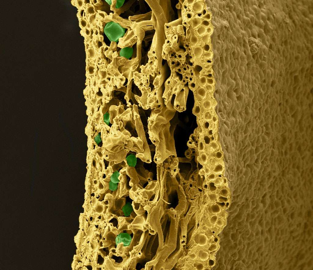 Coupe transversale d’un échantillon de Xanthoria parietina observé au microscope électronique à balayage. La face supérieure est située sur la partie gauche de l’image. On remarque un dense réseau d’hyphes (en jaune-orangé) et quelques cellules d’algues (en vert). © Yannick Agnan - Tous droits réservés