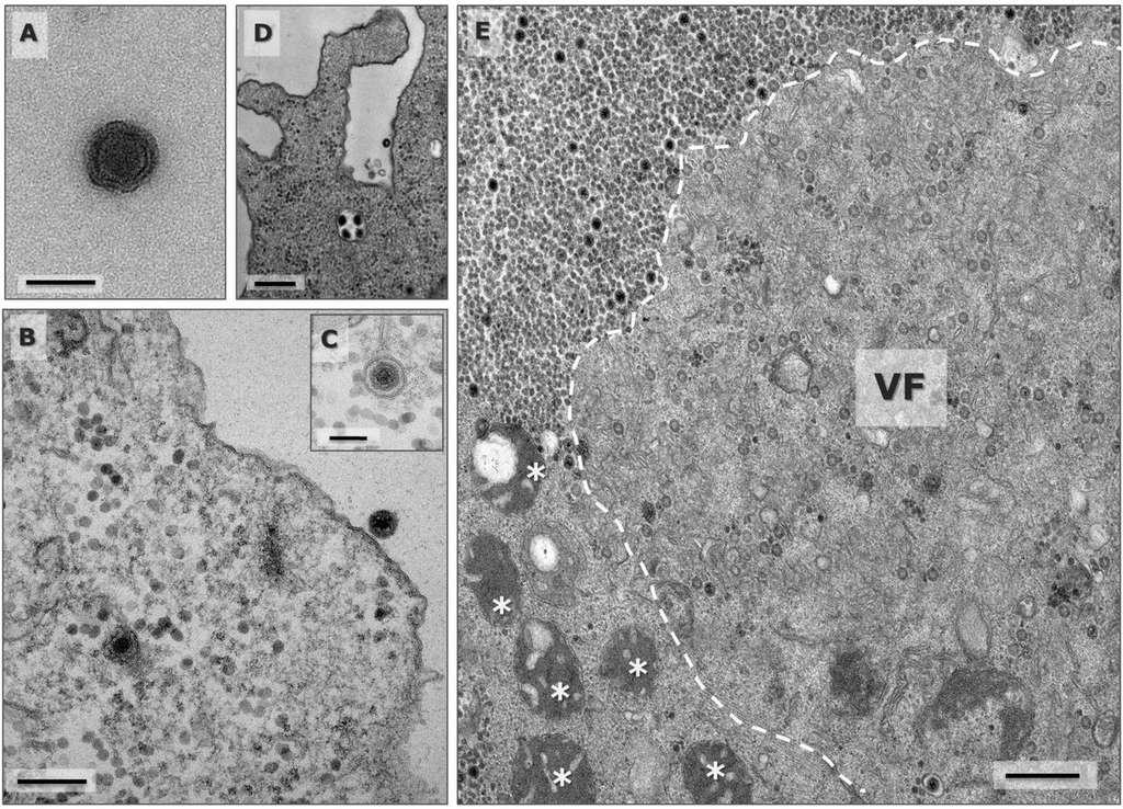 Le cycle viral du Yaravirus. Une particule virale est associée à la membrane de la cellule hôte de l’amine et pénètre à l’intérieur grâce à une vésicule endocytaire. Le virus occupe alors la région nucléaire de la cellule et « recrute » les mitochondries de celle-ci pour répliquer son ADN (image notée VF pour « viral factory »). © Paulo V. M. Boratto et al, bioRxiv, 2020