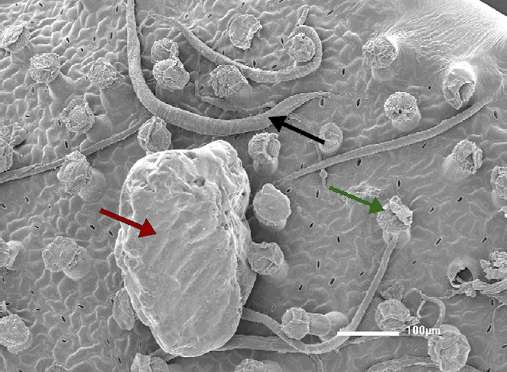 Surface d'une feuille de Philcoxia minensis. On distingue de nombreux nématodes (flèche noire), glandes sécrétrices (flèche verte) et un grain de sable (flèche rouge). © Pereira et al. 2012, Pnas
