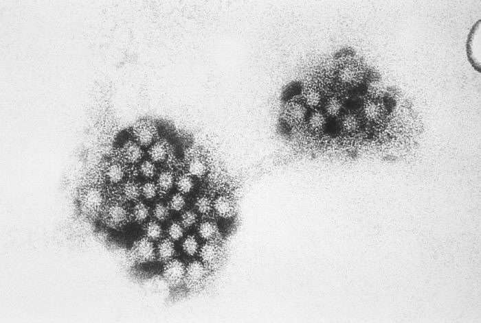 Une image au microscope électronique d'un virus de la famille des Caliciviridés. Ici, un spécimen du genre Norovirus. © CDC