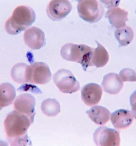 Le parasite Plasmodium infecte les globules rouges du sang humain. © CDC, Wikimedia Commons, DP